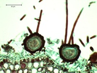 Figure 10.  Sexual ascospores are produced in sac-like asci enclosed in fruiting bodies (ascocarps).  Ascocarps of P. leucotricha contain a single ascus and have apical and basal appendages.  (Courtesy A. Baudoin from a Triarch Incorporated prepared slide).
