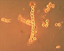 Figure 17. Lemon-shaped conidia of M. fructicola often occurring in “bead-like” strings. (Courtesy D.F. Ritchie)