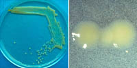 Figura 12. Yellow, mucoid bacterial colonies of Xanthomonas euvesicatoria grown on sucrose-peptone-agar medium. (Courtesy D.F. R