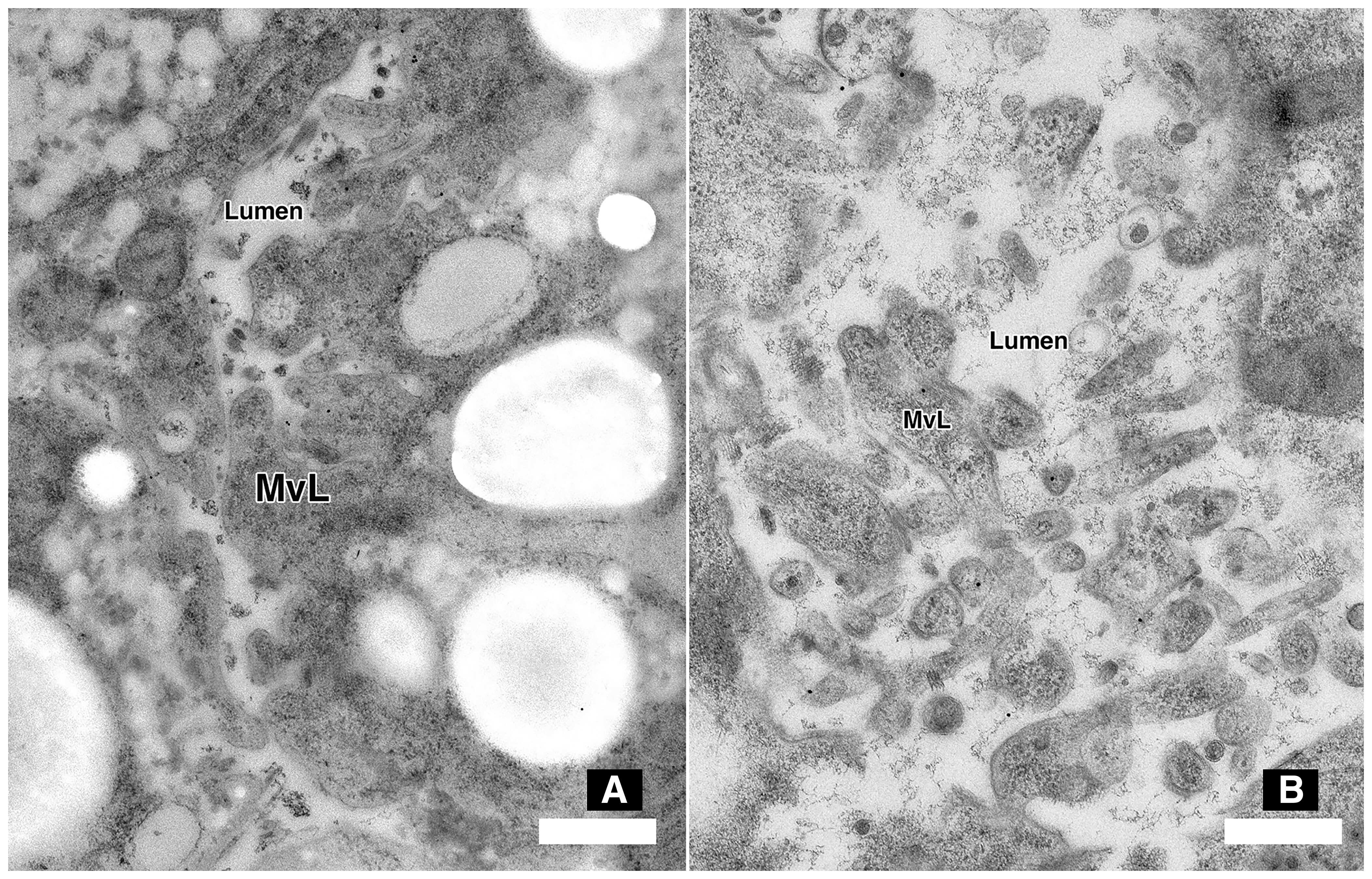 Comparison of anterior midgut ultrastructure in soybean cyst nematode (SCN) fed on A, wild-type or B, GMB151 (Cry14Ab-expressing