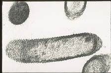 Figure 15. The undulating cell wall typical of Xylella fastidiosa. (Courtesy J.R. Hartman) 