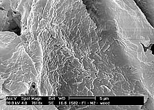 Figure 20b. Close-up of individual bacterial cells. (Used by permission of L. Marques; Leite et al., Phytopathology 95:963)