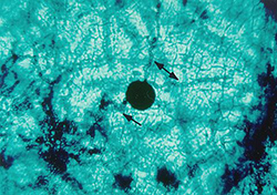 Figure 7. Pseudothecium of Venturia inaequalis embedded in leaf tissue. The arrows point to hyphae which may represent the two m