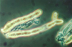 Figure 9. Asci of Venturia inaequalis containing ascospores (arrows). (Courtesy W. E. MacHardy)