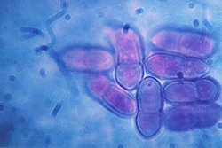 Figure 10. Two-celled ascospores of Venturia inaequalis. (Courtesy W. E. MacHardy)