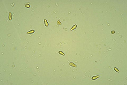 Figure 12. Conidia of Spilocaea pomi (Venturia inaequalis). (Courtesy J. Hartman)