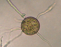 Figure 28. Asexual Phytophthora nicotianae chlamydospore; note thick wall that aids in survival.