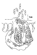 Figure 11. Pseudothecium of Mycosphaerella fijiensis. (From Ninoska, Pons. 1987. Notes on Mycosphaerella fijiensis var. difformi