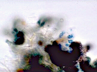 Figure 12. Squash mount of pseudothecia of Mycosphaerella fijiensis. The eight ascospores within each ascus picked up the blue s