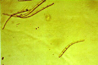 Figure 14. Conidia of Pseudocercospora fijiensis. (Courtesy A. Johanson)