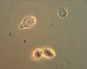 Figure 18. Lemon-shaped conidia and germinating conidium (upper left) of M. fructicola. (Courtesy D.F. Ritchie) 