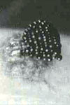 4. Ruptured perithecium on a melon root liberating ascospores. 