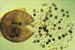 Ruptured perithecium exuding mature and immature ascospores