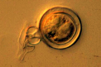 Figure 15. An oospore of Phytophthora capsici with amphigynous antheridium (see arrow). (Courtesy M. Babadoost)