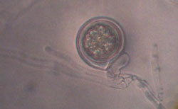 Figure 6b. Phytophthora sojae oospore with paragynous antheridium (antheridium is to the side of the oogonial stalk) (Courtesy K. Broders). 