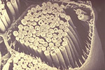 Figure 7. Pine wood nematodes in tracheae of the pine sawyer beetle. The round structures are cross-sections of the nematode. (Courtesy E. Kondo)