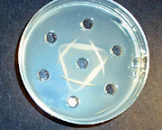 Figure 7: Typical results for a double diffusion - two reaction type test. Simulated antigens are placed in alternate wells. Both simulated antibodies are placed in the center well. (Courtesy D. Schadler)